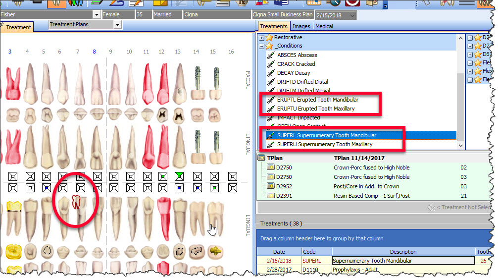 Supernumerary Teeth Chart